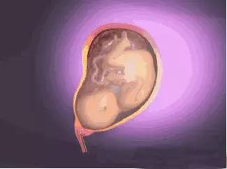 宝宝腿什么样是正常的,婴儿腿弯是o型腿吗