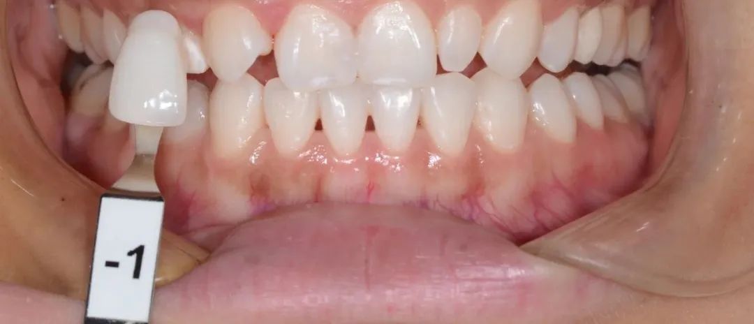 口腔牙医感言,牙医从业感悟