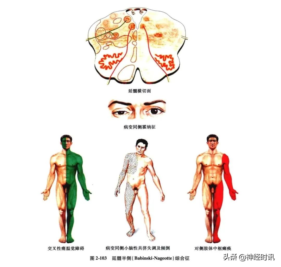 脑干解剖,脑干神经解剖