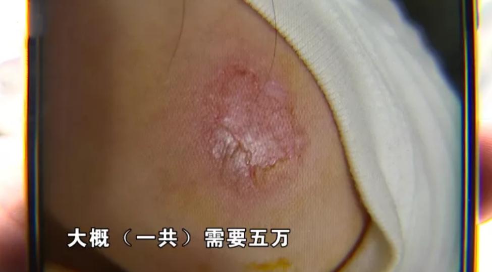 濂冲浣撻獙淇剼,濡瑰瓙浣撻獙淇剼