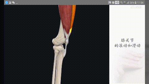 压腿很痛怎么办,为什么压腿时膝盖窝好痛