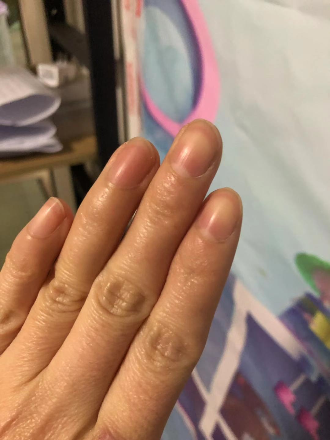 十个手指看健康图解,看手指知道身体情况