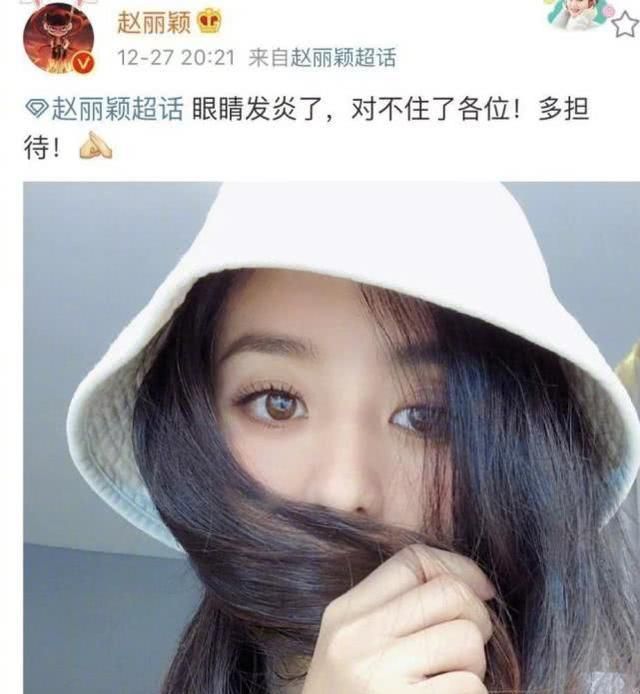 赵丽颖眼睛肿是怎么回事,赵丽颖眼睛长麦粒肿是因为拍戏吗