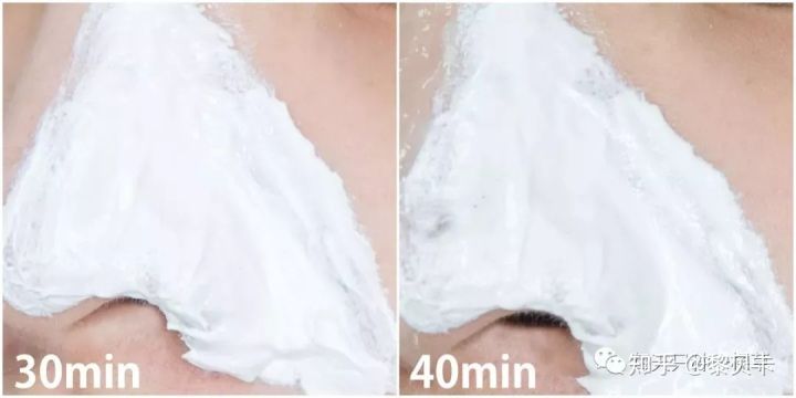 黑头去除神器排行榜,黑头粉刺清除强力推荐网红产品