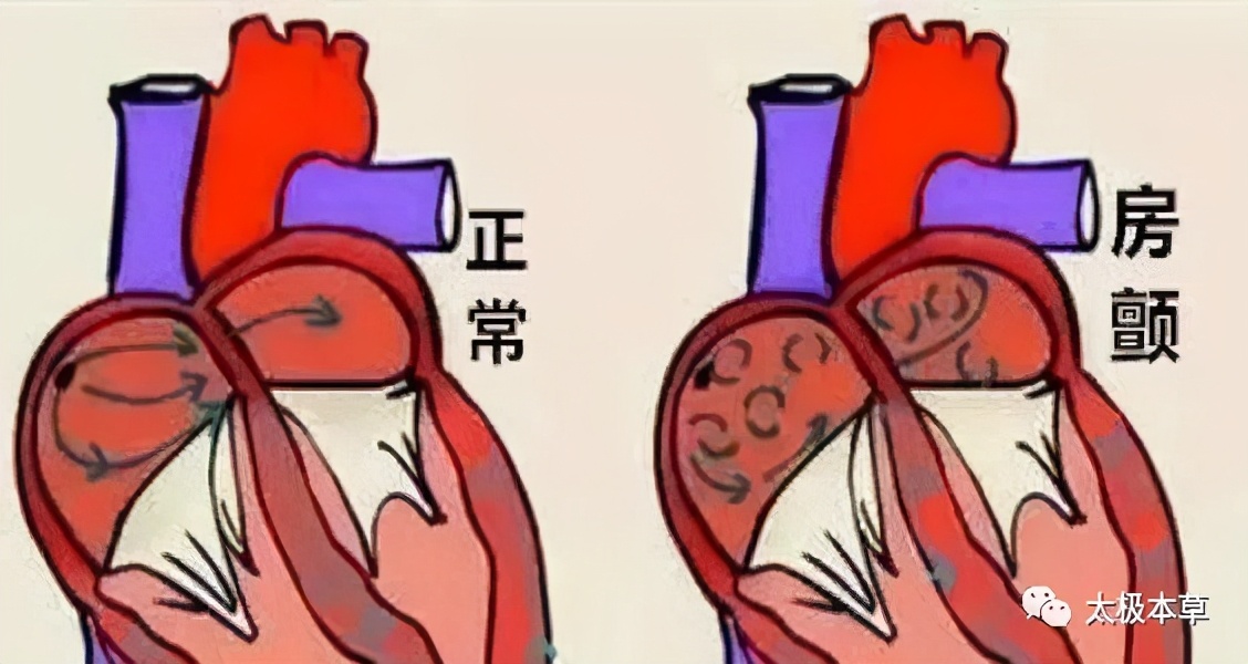 心脏早搏这个病怎么治啊,心脏早搏这怎么回事