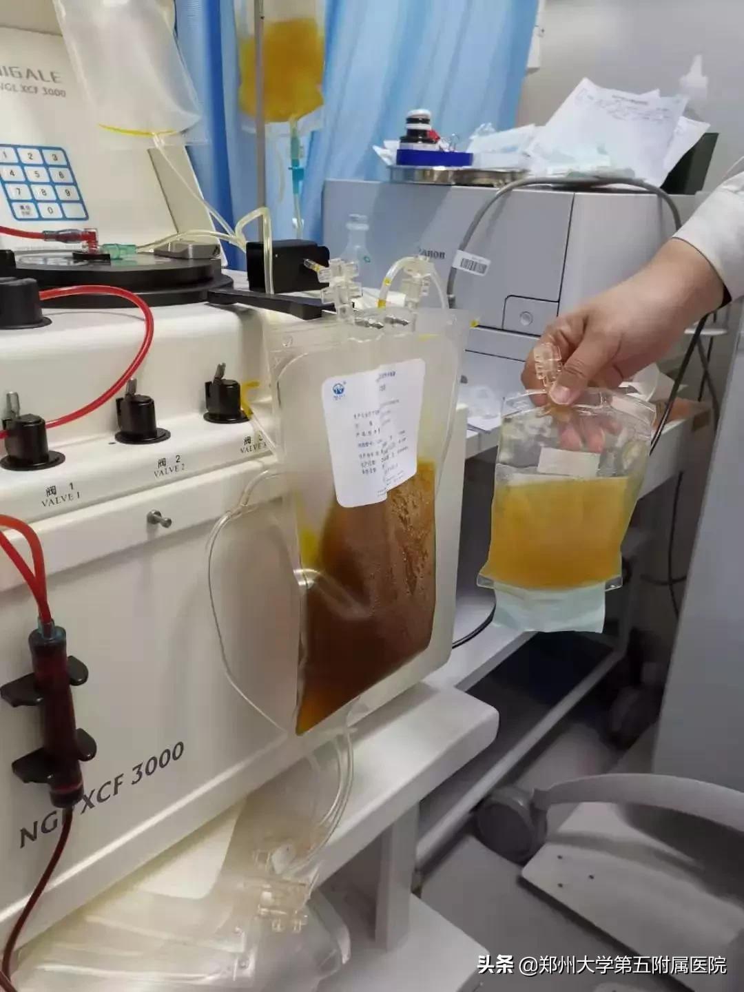 肝病患者血脂高用什么药,临床高胆固醇血症的治疗