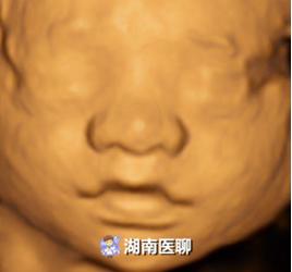 错过预约四维彩超最佳时间怎么办,四维彩超错过预约时间了怎么办