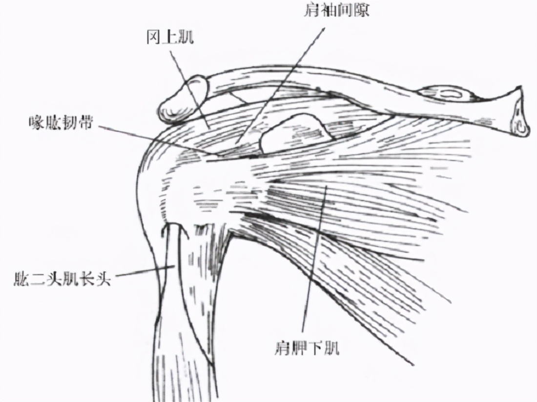 治疗肩周炎的穴位,肩周炎的治疗膏药