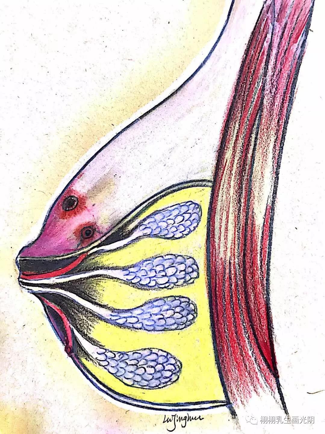乳腺炎的6大现象,怎么确定是真正的乳腺炎