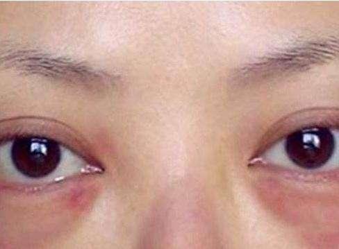 烫睫毛真的好用吗,烫睫毛靠谱吗