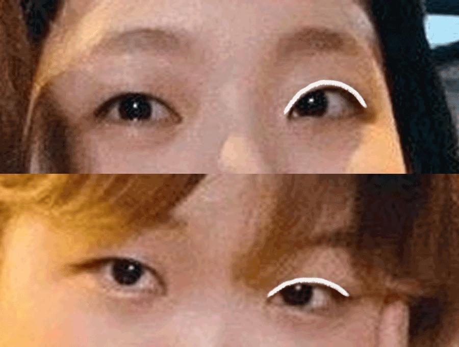 双眼无神怎么变得有神吃点什么,双眼无神怎么变得有神