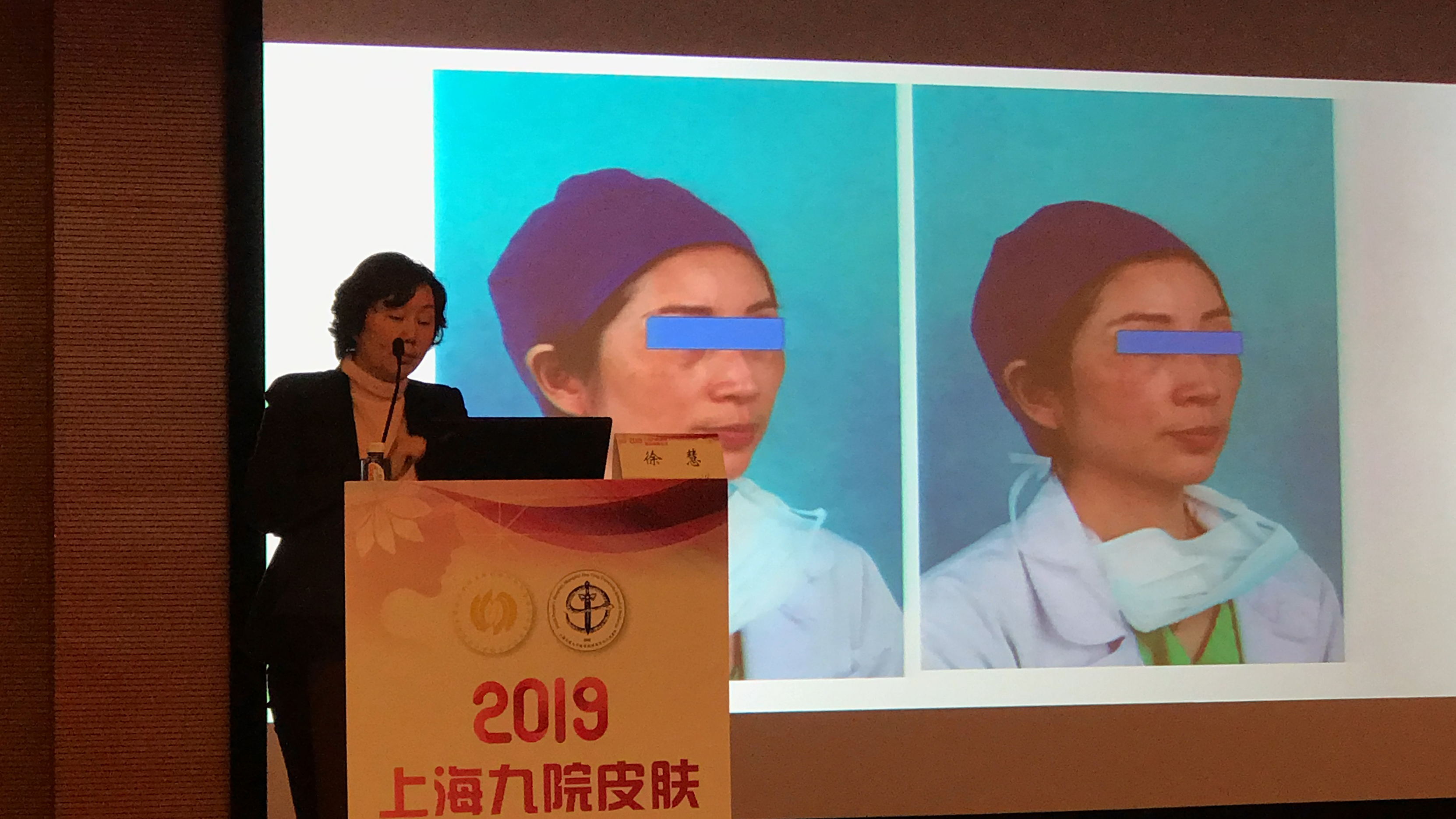 上海九院修复因子,上海九院整形科皮秒祛斑