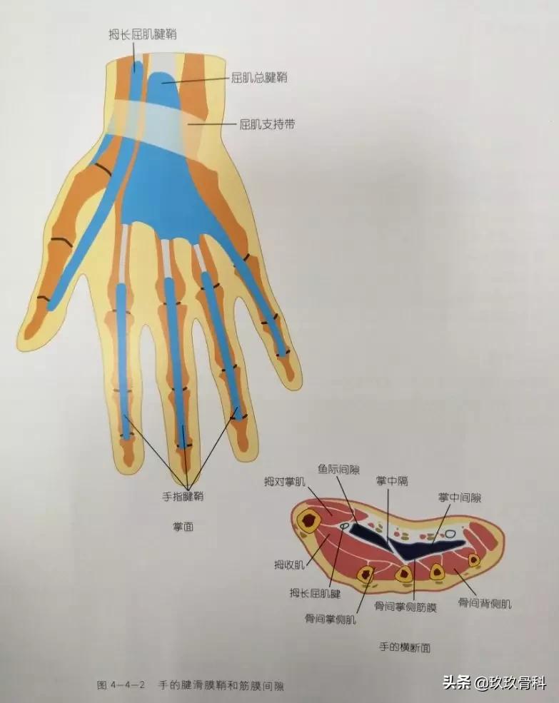 腱鞘囊肿针刺技巧视频,手指腱鞘囊肿正确挤压方法视频