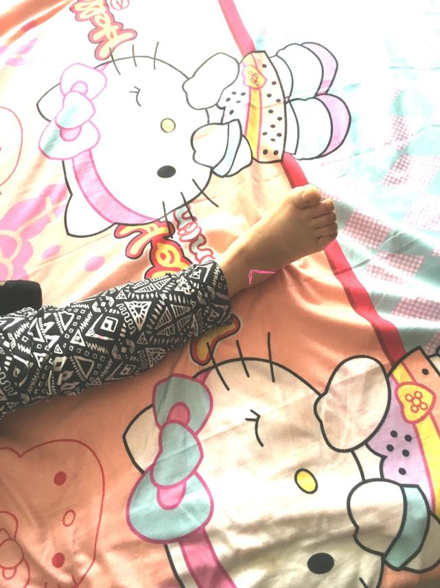 脚腕扭伤恢复后脚腕变粗活动受限,脚腕扭伤了怎么恢复最快