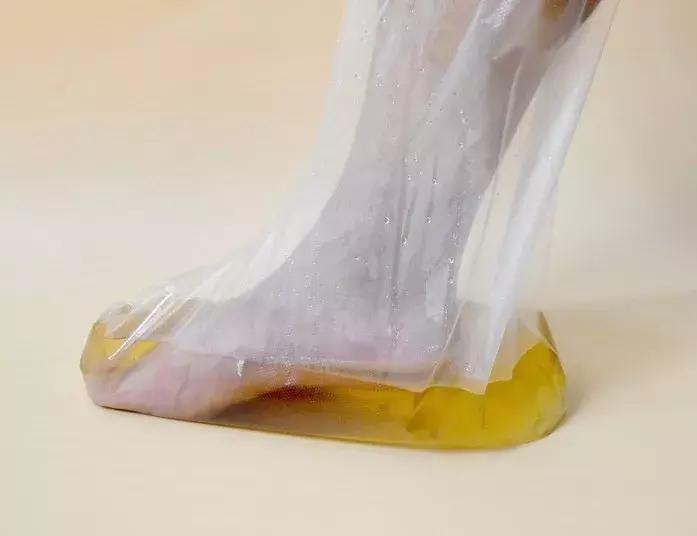 微创拇外翻手术有哪些后遗症,拇外翻微创手术效果好吗