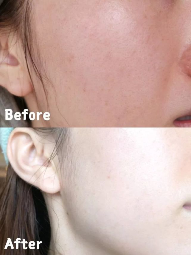 “最憋屈”的国货，不到30元！补水保湿样样不差，一用了好多年