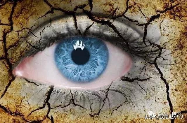 干眼症中医治疗好还是西医治疗好,干燥综合症引起的干眼症怎么治疗