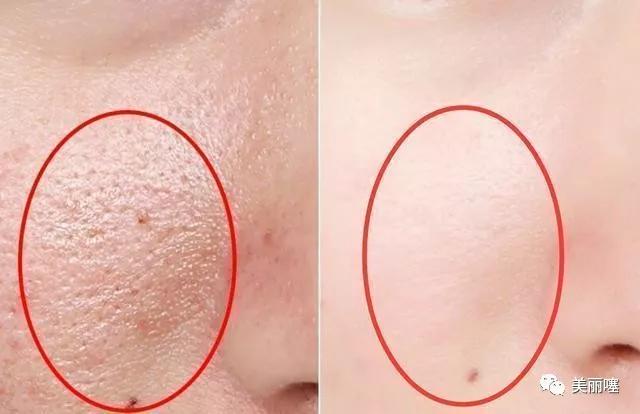 屈臣氏兰蔻粉水多少钱,屈臣氏兰蔻粉水是正品吗