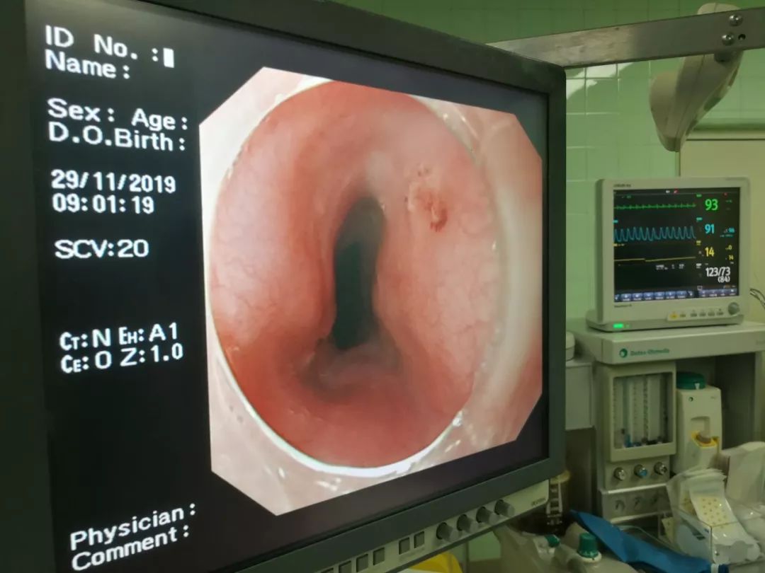 一只鸭引发血案,一只鸭引发的血案