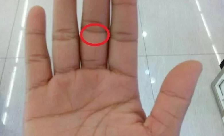 手健康有多重要,手型看健康