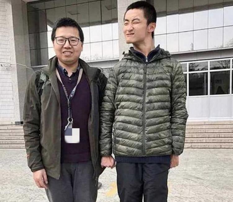 严重脑瘫神童,中国天才少年脑瘫