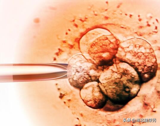 试管婴儿奇葩问题,做试管婴儿是谁的问题