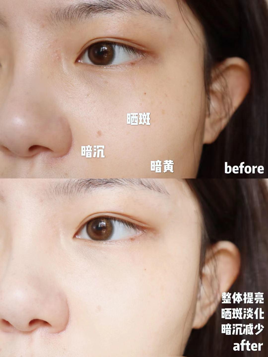 科颜氏提亮美白,小灯泡小银瓶科颜氏淡斑