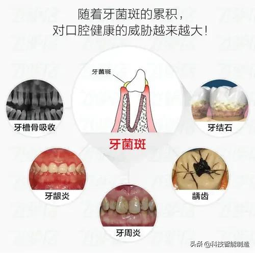 每秒振动1.5万次以下,一分钟震动10万次的牙刷