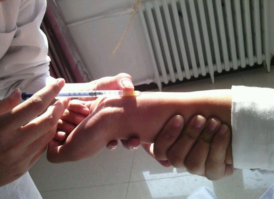 柴房惊现“烂草蛇”！广东66岁老人被咬伤！这是什么蛇？有多毒？