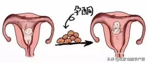 孕酮低容易流产吗,孕期孕酮低就会流产