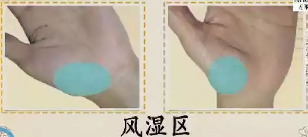 手诊10种常见病从手上就能看出来,手形看健康