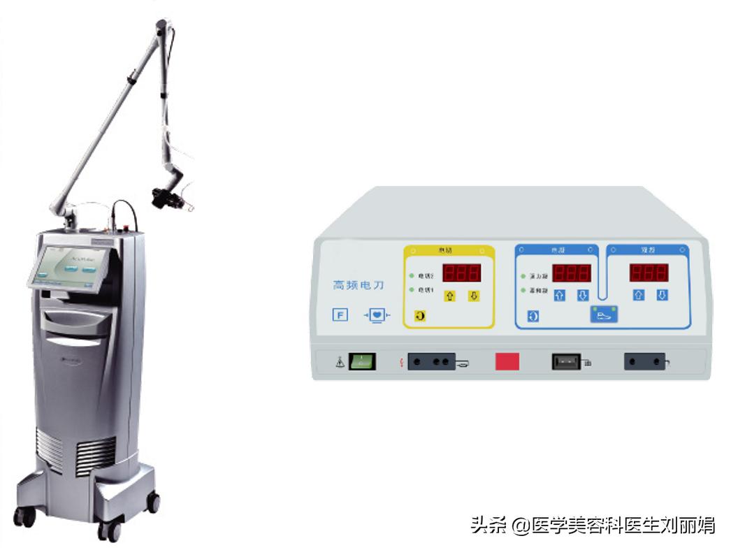 尚雯婕单眼皮吗,尚雯婕参加王牌视频