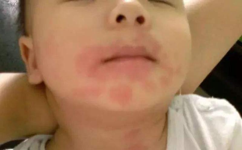 儿科专家把3种辅食拉进黑名单,辅食黑名单一览表