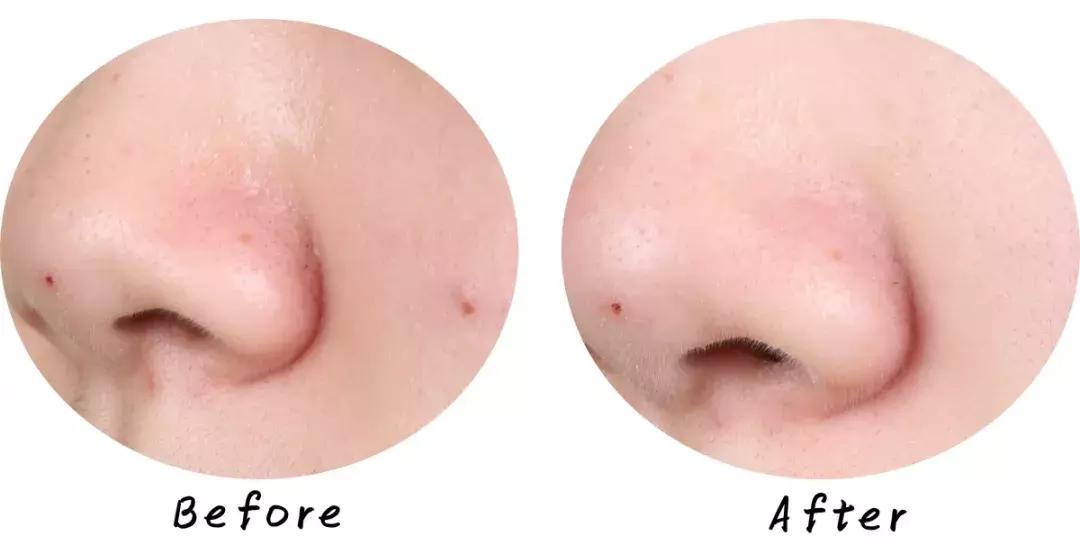 最好用清洁面膜排行榜前十名图片,公认最好用的清洁面膜混油皮