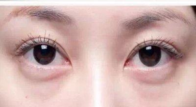 面霜去皱纹去眼袋,去眼袋皱纹的产品