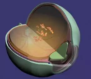 眼前一直有蚊子是什么病,眼前总有蚊子飞怎么治呀