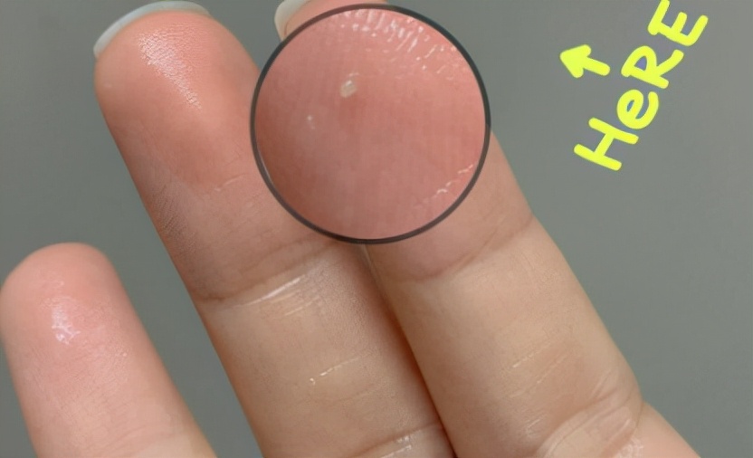 妊娠纹擦婴儿油,婴儿油功效