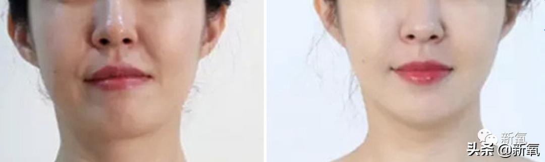 杨超越还能撑多久,杨超越遇到的真实事件