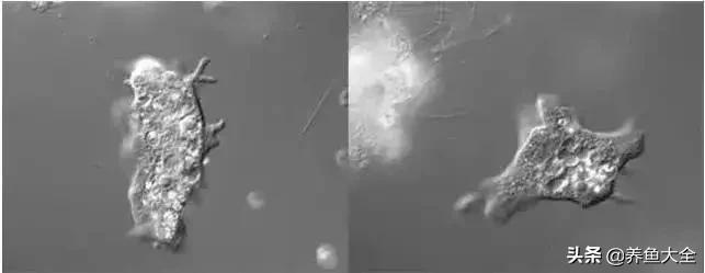 寄生虫多达6000条这种东西别乱吃,寄生虫的典型症状和表现