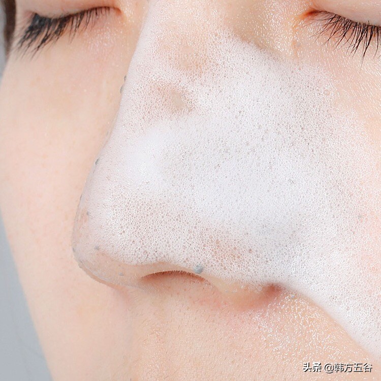 搓澡之后毛孔有血点怎么弄掉,搓出皮肤脏东西