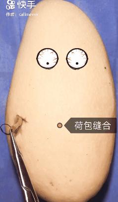 我在快手上看人切洋葱，竟然弄懂了剖腹产？