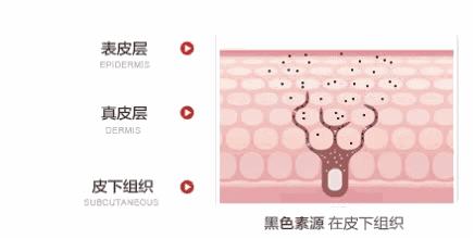 激光美白建议做吗,对激光还有哪些了解