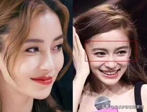 男士熬夜细纹黑眼圈用什么眼霜,熬夜眼袋用什么眼霜能消除