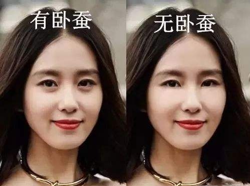 祛眼袋没有卧蚕了,没有卧蚕明星