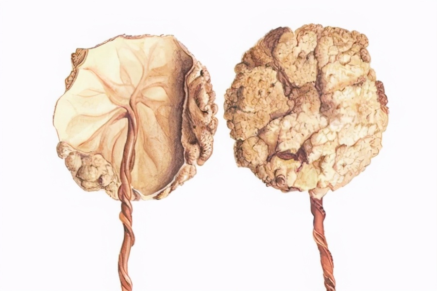 产后胎盘如何处置比较好,产后胎盘你们都怎么处置