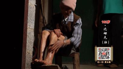 老人夏天发痧,痧气重怎么祛除吃什么好得快