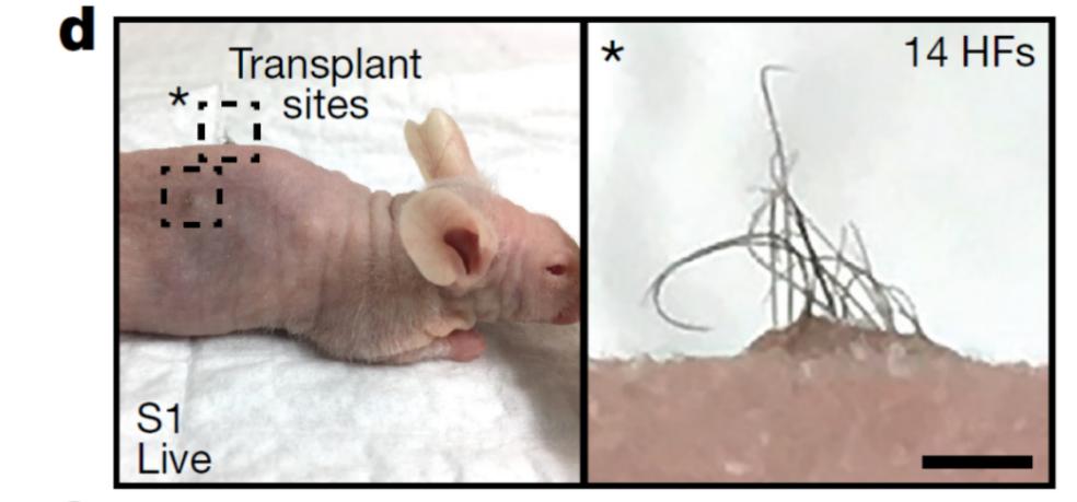 脱发人群超25亿解救头发从它开始,脱发最新研究成果
