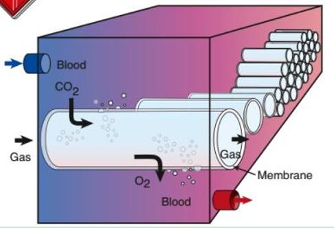 全球抢中国呼吸机视频,中国呼吸机紧缺性