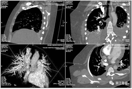 颈肩痛用针刺疗法效果好吗,颈肩腰腿疼儿童疾病