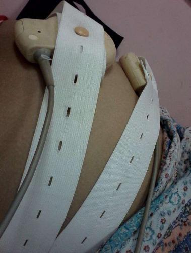 胎心监护要知道的事,有关胎心的科普